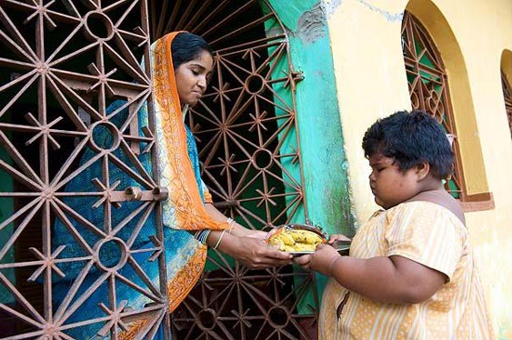 印度女孩5歲150斤醫生擔心活活吃死