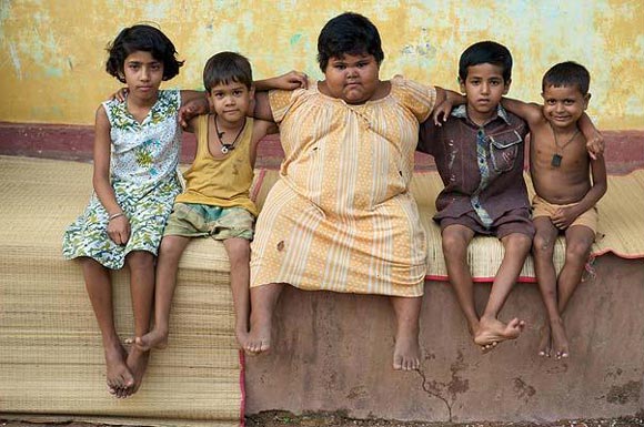 印度女孩5歲150斤醫(yī)生擔(dān)心活活吃死