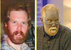 美國男子服藥產(chǎn)生副作用 變作”藍(lán)精靈“