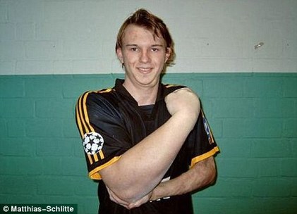 德小伙“掰手腕”稱霸 45厘米粗右前臂堪比大力水手