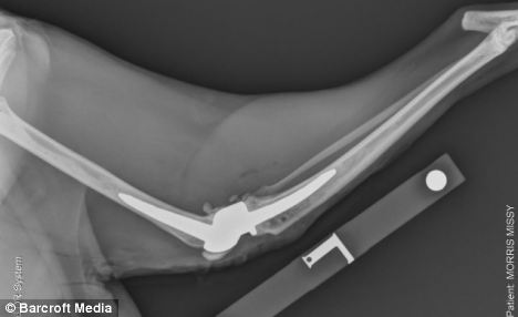 英國小貓遭車禍撞碎腿 安人造膝蓋開世界先河