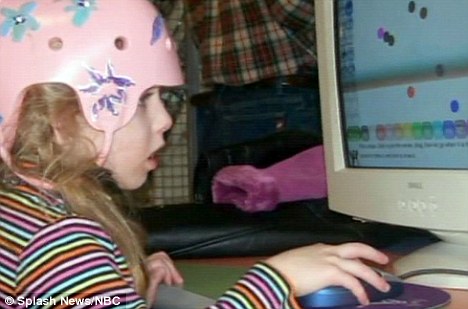 美國9歲女孩切除半個大腦 奇跡康復震驚醫生