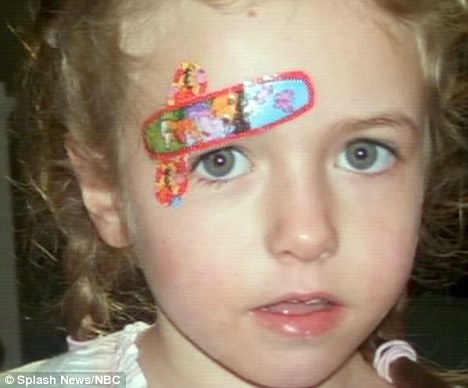 美國9歲女孩切除半個大腦 奇跡康復震驚醫生