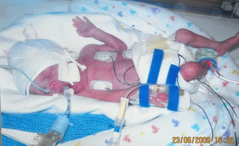 英少女陣痛20天終成功生產 堪稱“史上最牛孕婦”