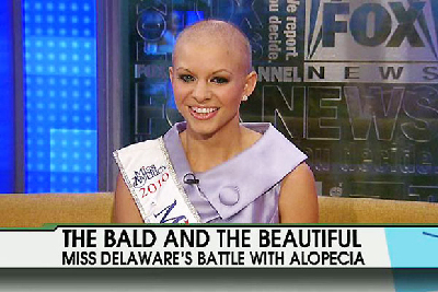 “光頭美人”奪美國特拉華州選美大賽冠軍