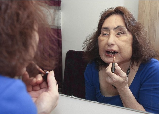 美國“換臉女”的人生奮斗 雖與兇手丈夫離婚但愛心不變