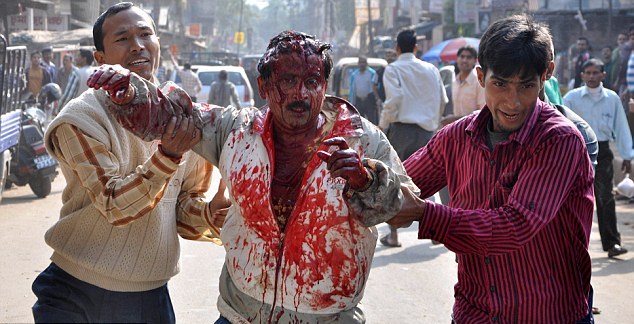 豹子闖入印度居民區(qū)重傷4人 男子徒手招架被掀掉頭皮