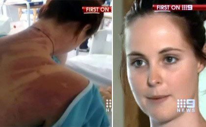 蹦極時(shí)繩索斷裂 澳大利亞女孩兒墜入鱷魚河奇跡逃生