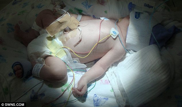 英國一新生兒體內幾乎無血 輸血后奇跡存活