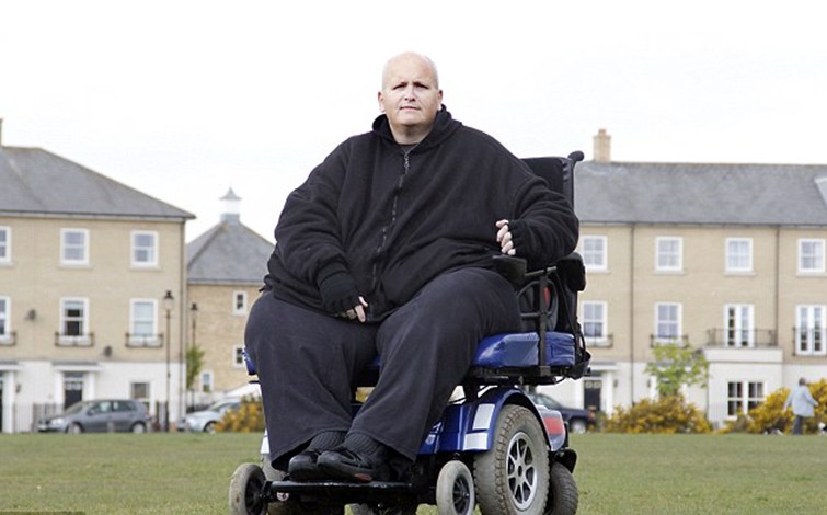 原世界最胖男子減肥后皮膚下垂 渴望切除多余皮膚