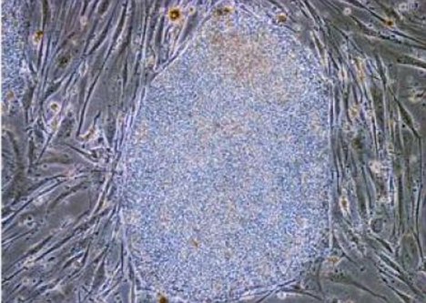 日本科學家造出“癌癥殺手”細胞 系全球首創有望注射使用