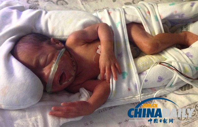 美夫婦生下雙胞胎后又迎來五胞胎