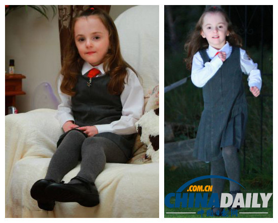 英出生不足1斤女嬰裹氣泡布存活