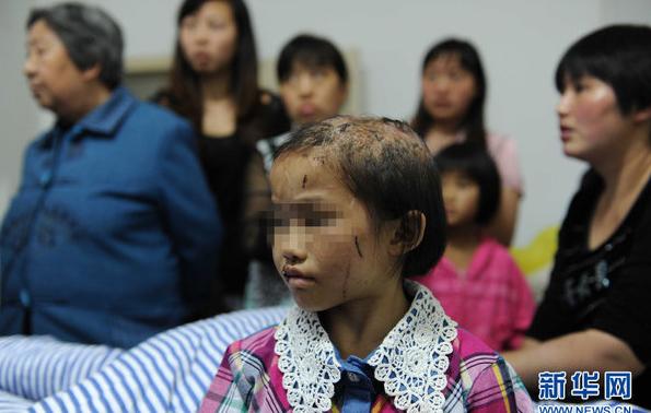 男子虐待親生女5年：開水燙頭、魚線縫嘴、跪碎玻璃(圖)