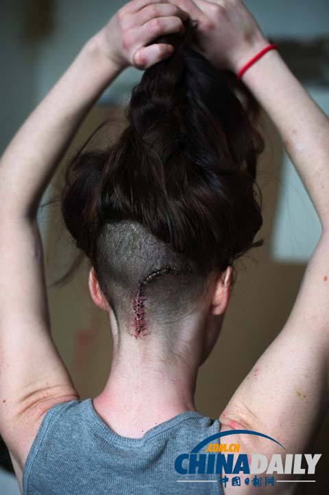 美麗蛻變！實拍吸毒女孩的戒毒歷程