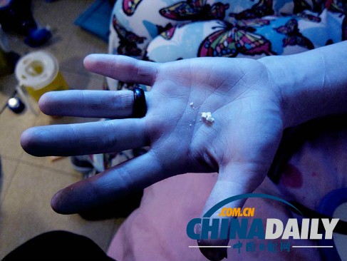 美麗蛻變！實拍吸毒女孩的戒毒歷程