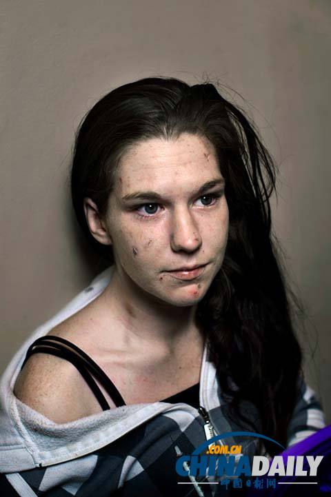 美麗蛻變！實拍吸毒女孩的戒毒歷程