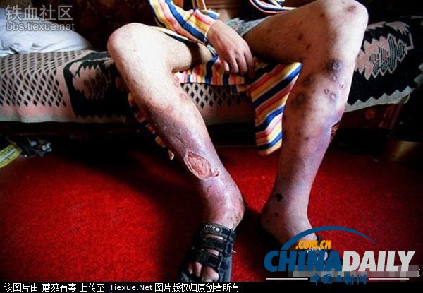 美麗蛻變！實拍吸毒女孩的戒毒歷程