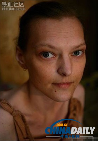 美麗蛻變！實拍吸毒女孩的戒毒歷程