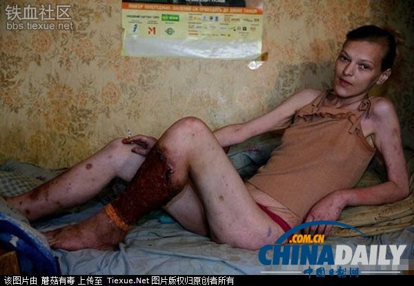 美麗蛻變！實拍吸毒女孩的戒毒歷程