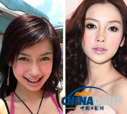 柳巖李小璐楊冪 女星整容前驚人對比照