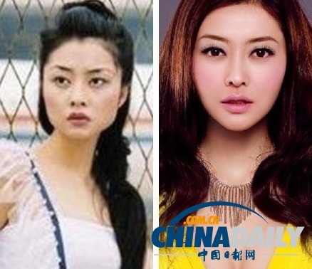 柳巖李小璐楊冪 女星整容前驚人對比照
