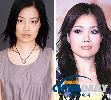柳巖李小璐楊冪 女星整容前驚人對比照