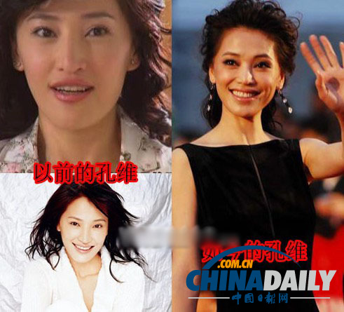 柳巖李小璐楊冪 女星整容前驚人對比照