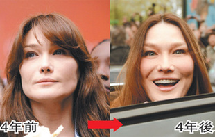 法國第一夫人被疑整形過度