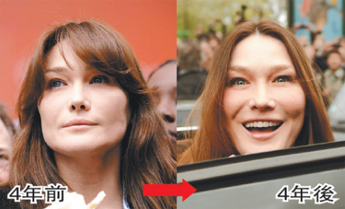 圖:法國第一夫人被指容顏大變 疑整形過度