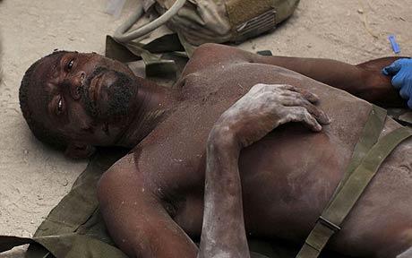 海地再度上演生命奇跡：35歲男子被埋14天后生還