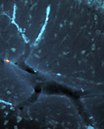 圣誕趣聞：針葉樹變“布丁” 腦血管圖現“馴鹿”