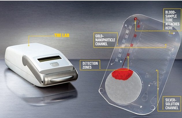 美國研制成功艾滋病快速驗血裝置 15分鐘出結果成本僅1美元