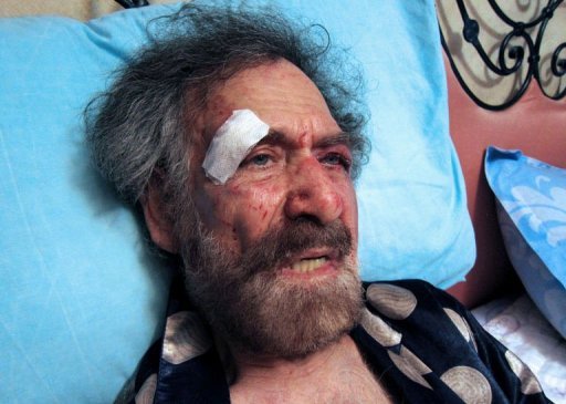 因諷刺政府和總統 敘利亞著名漫畫家遭蒙面人毒打