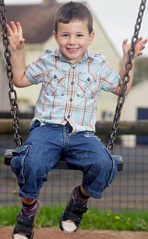 英男孩為除胎記腦門“冒出”犄角 酷似“小龍人”