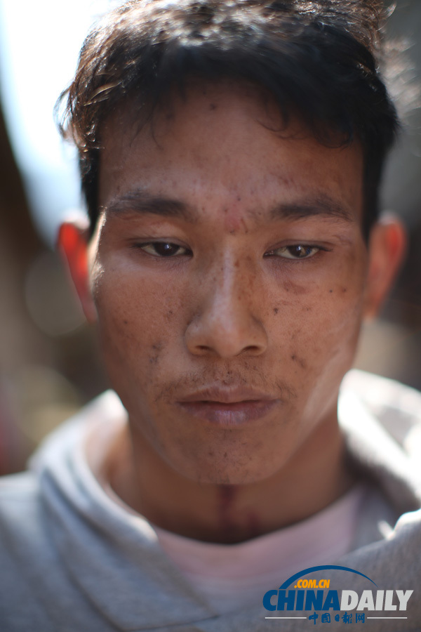 緬甸克欽拉咱：生活在安置點的民眾（組圖）