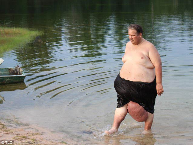 妻遭謀殺 美國(guó)男子患暴食癥體重暴漲到318公斤