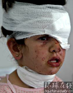 以總理再提停戰條件 UN駐黎部隊遭以攻擊