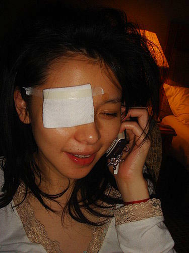 徐若瑄右眼包紗布變獨眼龍否認被歌迷砸傷