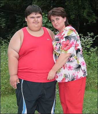 俄羅斯9歲男童147公斤 或為世界最胖小孩健康有風險