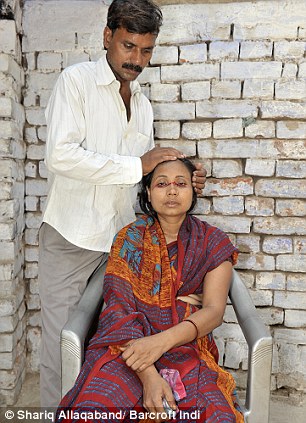 “他們說我魔鬼附身” 美國少年流“血淚”醫生無解