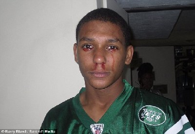 “他們說我魔鬼附身” 美國少年流“血淚”醫生無解