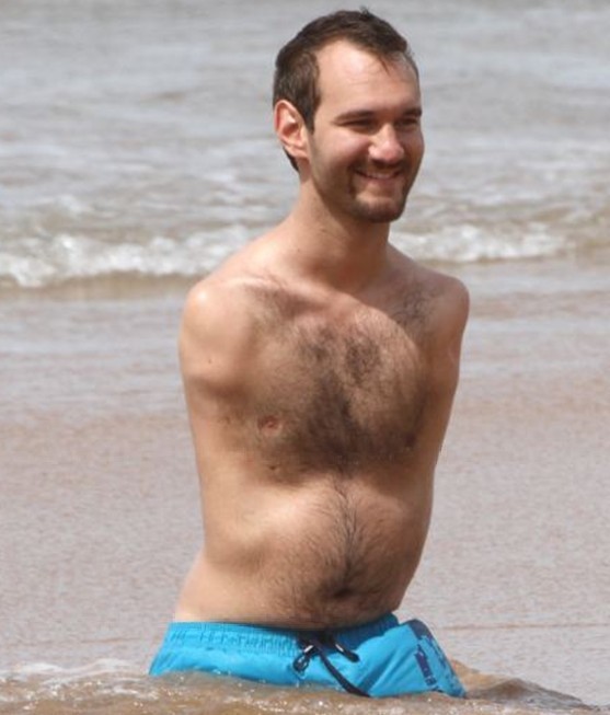 沒有四肢生活也很精彩!澳勵志哥夏威夷享受浪漫蜜月