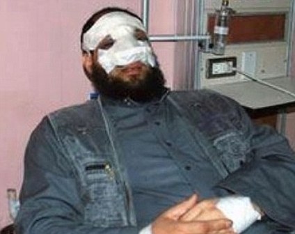 違反教義隆鼻卻謊稱遭襲 埃及議員丟臉丟官還可能坐牢