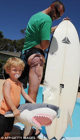 澳男子沖浪時被鯊魚咬掉3.6斤肉 失血過多險喪命