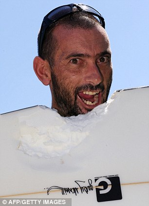 澳男子沖浪時被鯊魚咬掉3.6斤肉 失血過多險喪命