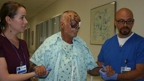 美“食臉”受害者能下地走動 多半傷口結痂、要聽NBA總決賽