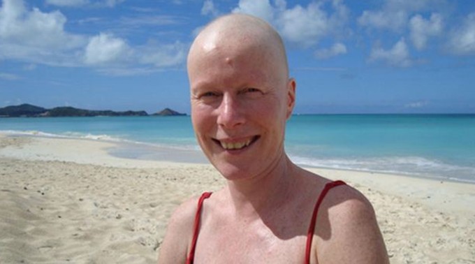 食療勝過藥物?英國一乳腺癌患者用姜黃粉抗腫瘤復發