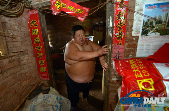 重慶最新第一胖 身高1.65米體重180公斤