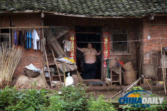 重慶最新第一胖 身高1.65米體重180公斤